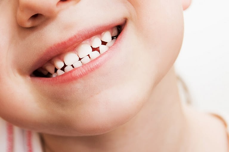 5 Ways to Protect Baby Teeth